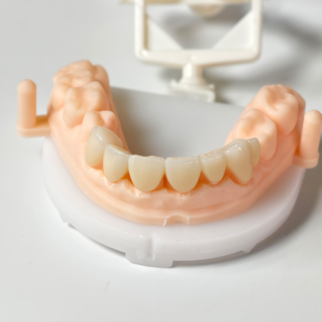High - Strength Zirconia Crown