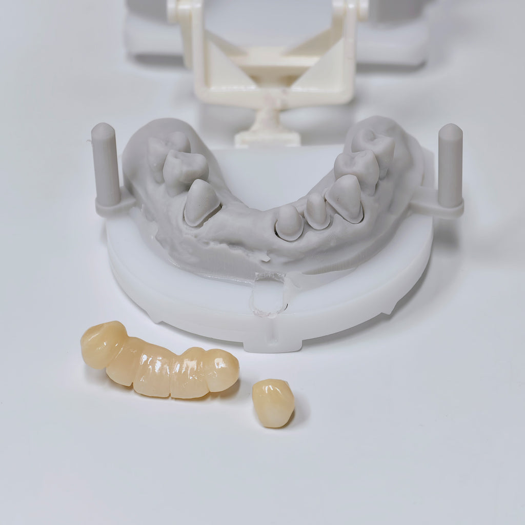High - Strength Zirconia Crown And Bridge