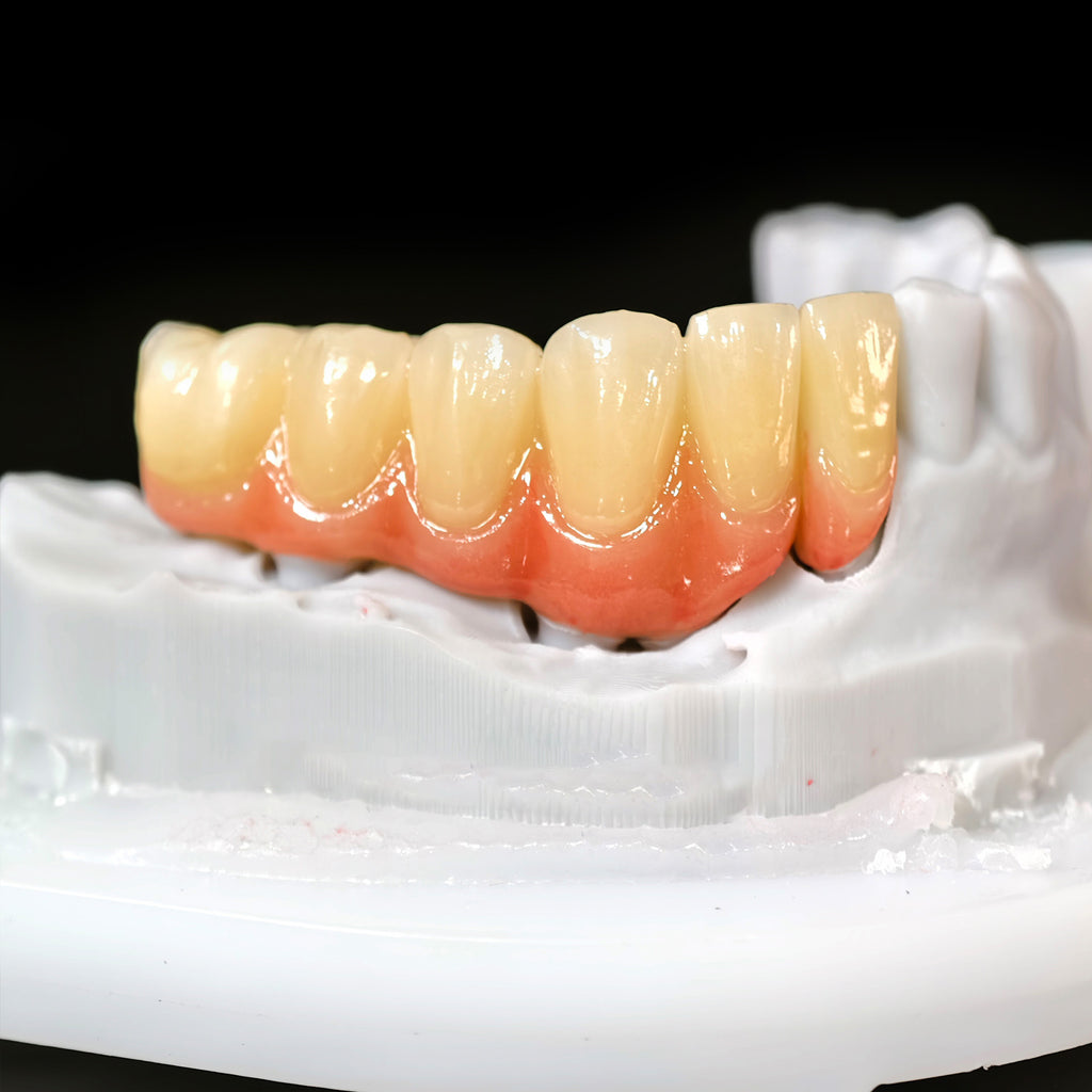 High - Strength Zirconia Crown And Bridge