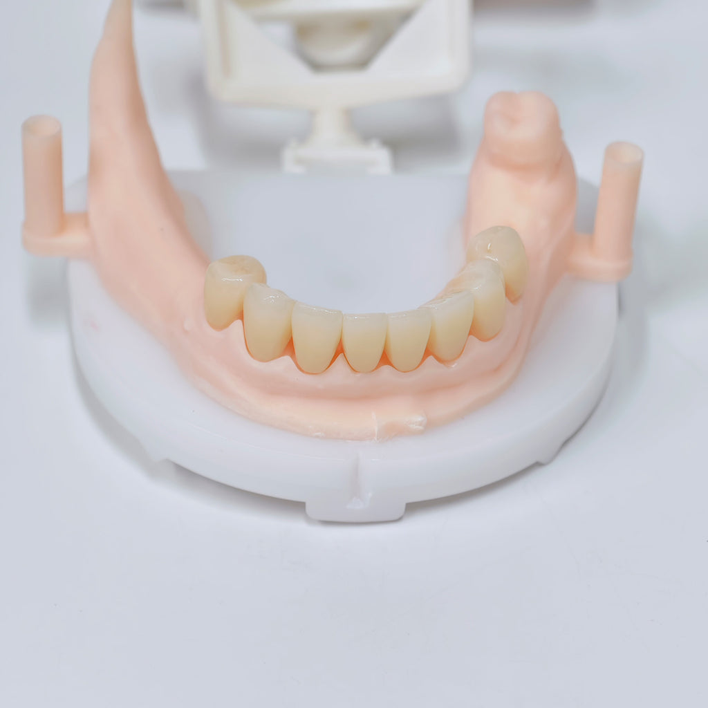 High - Strength Zirconia Crowns