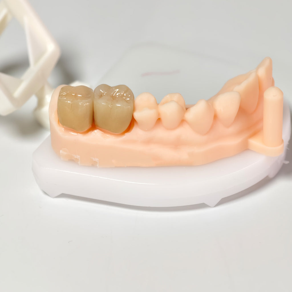 High - Strength Zirconia Crowns