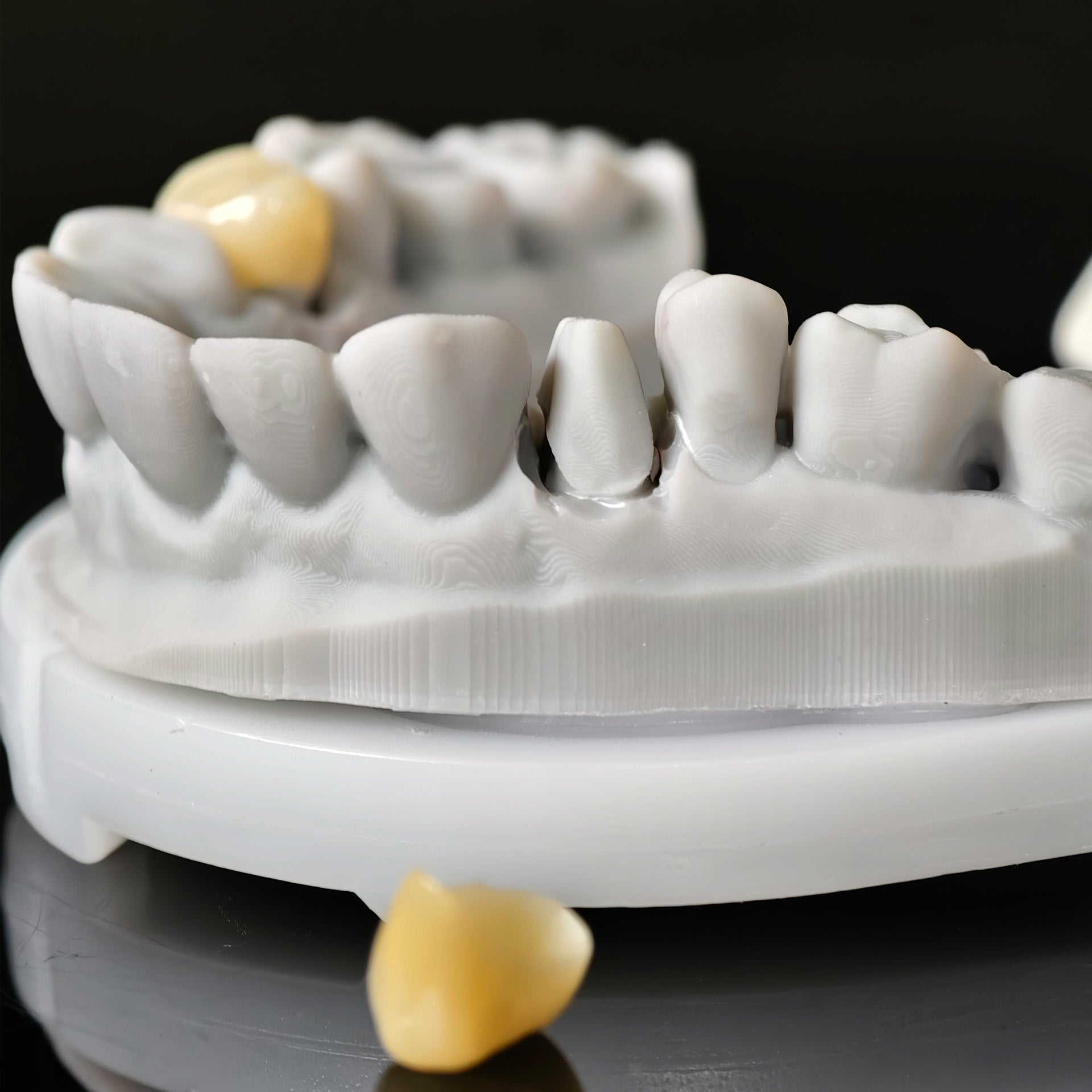 High - Strength Zirconia Crowns