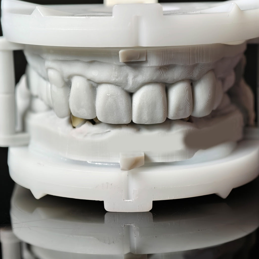 High - Strength Zirconia Crowns