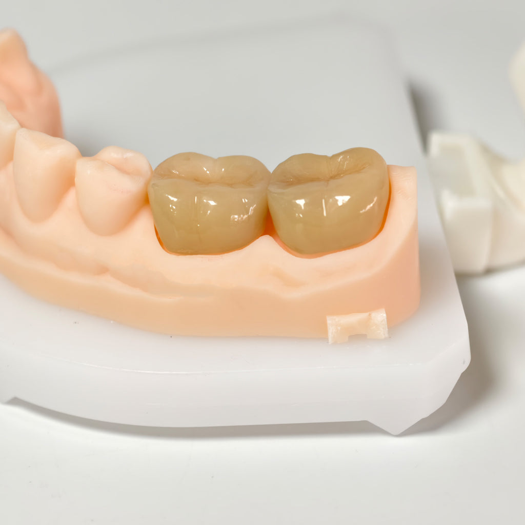 High - Strength Zirconia Crowns
