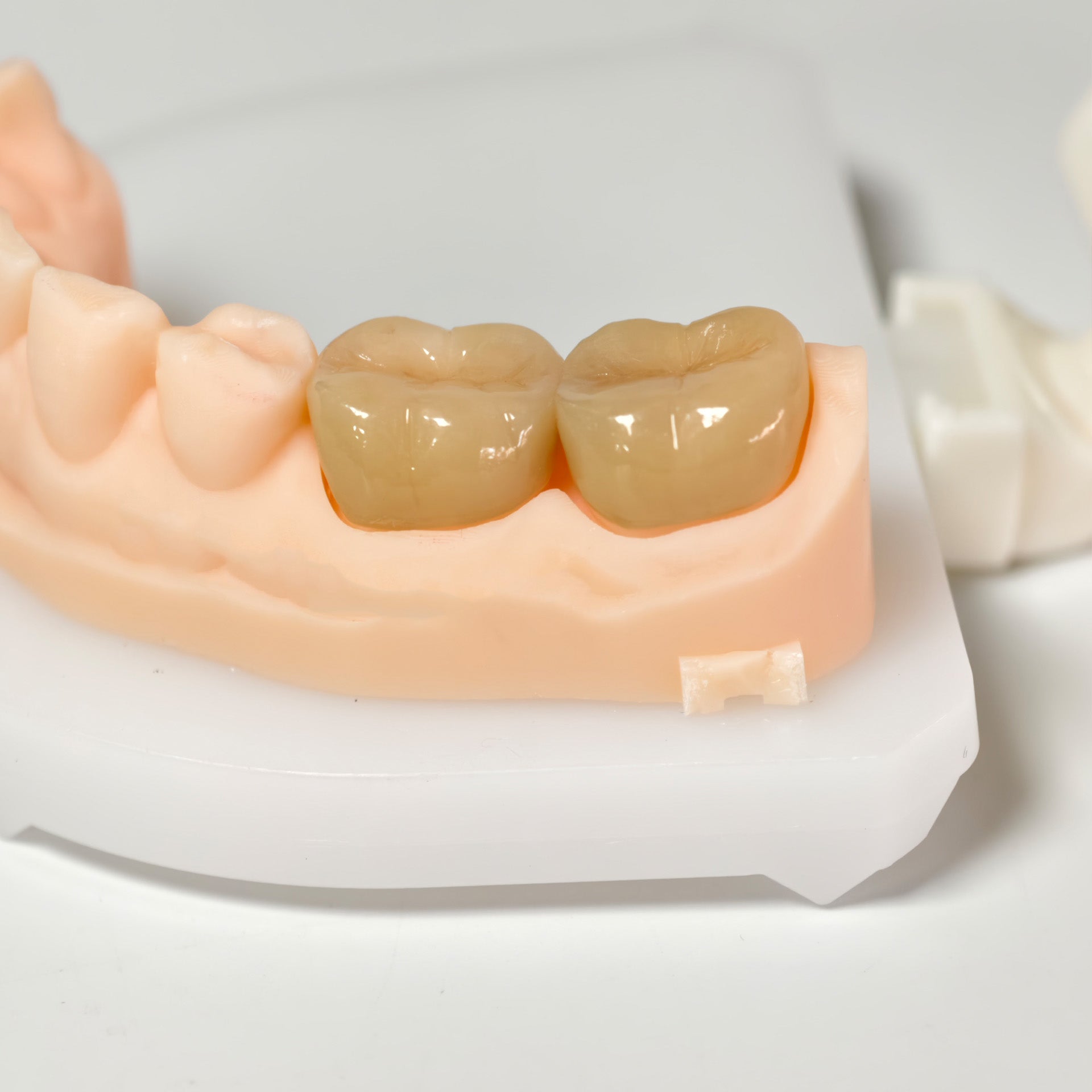 High - Strength Zirconia Crowns