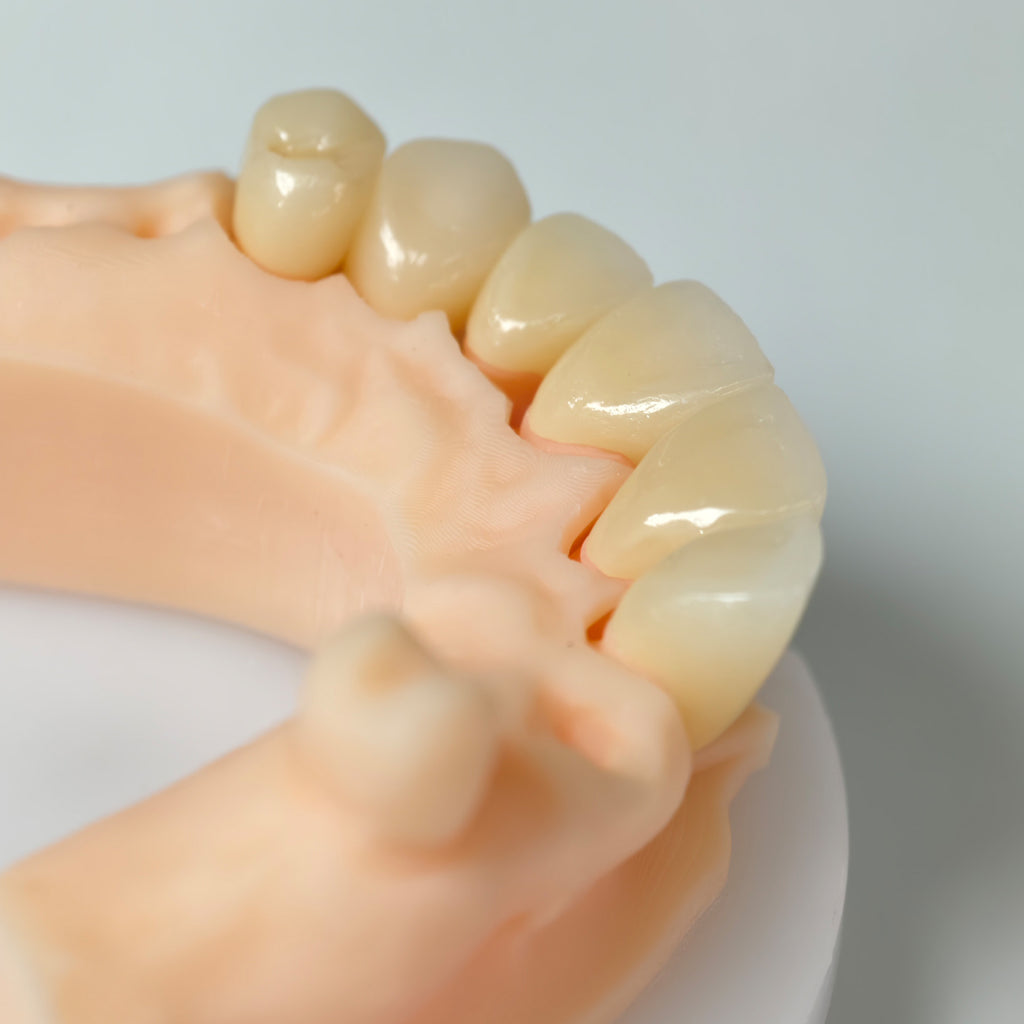 High - Strength Zirconia Crowns