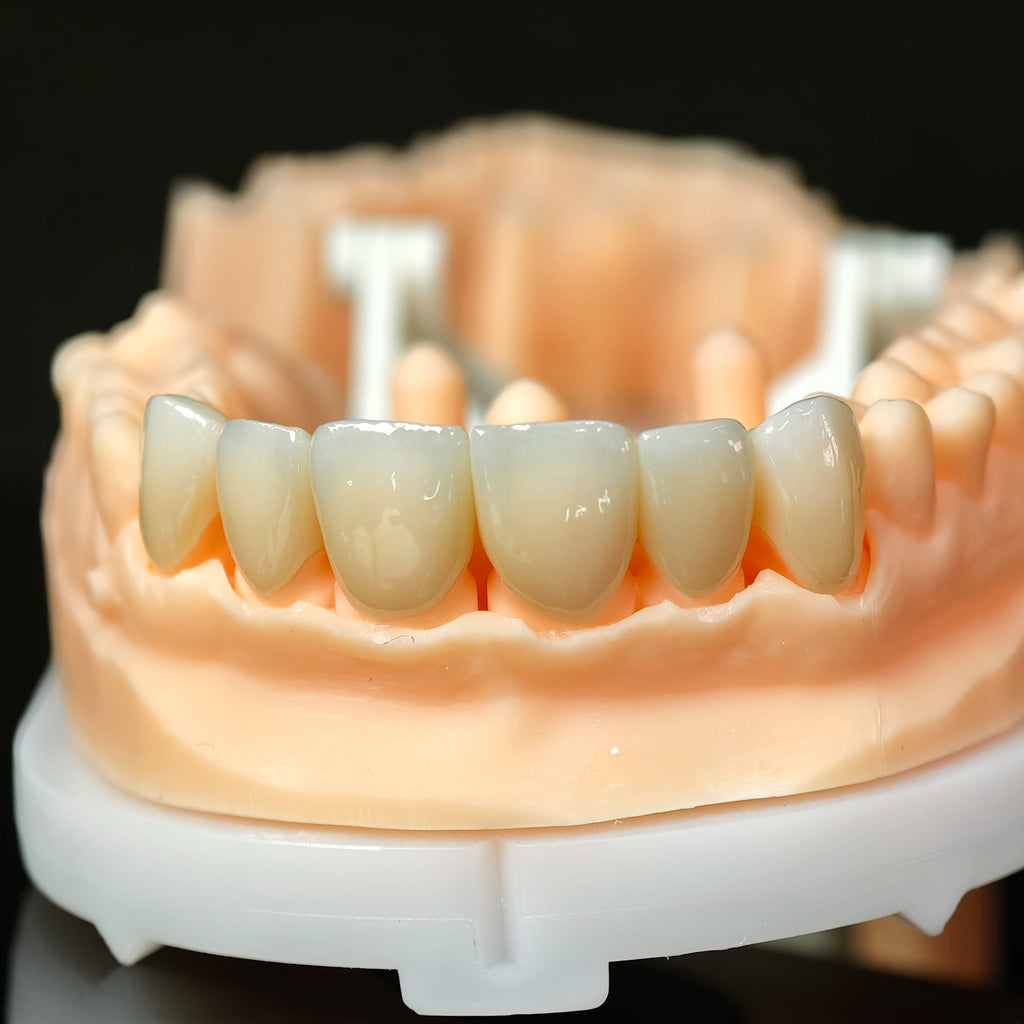 High - Strength Zirconia Crowns
