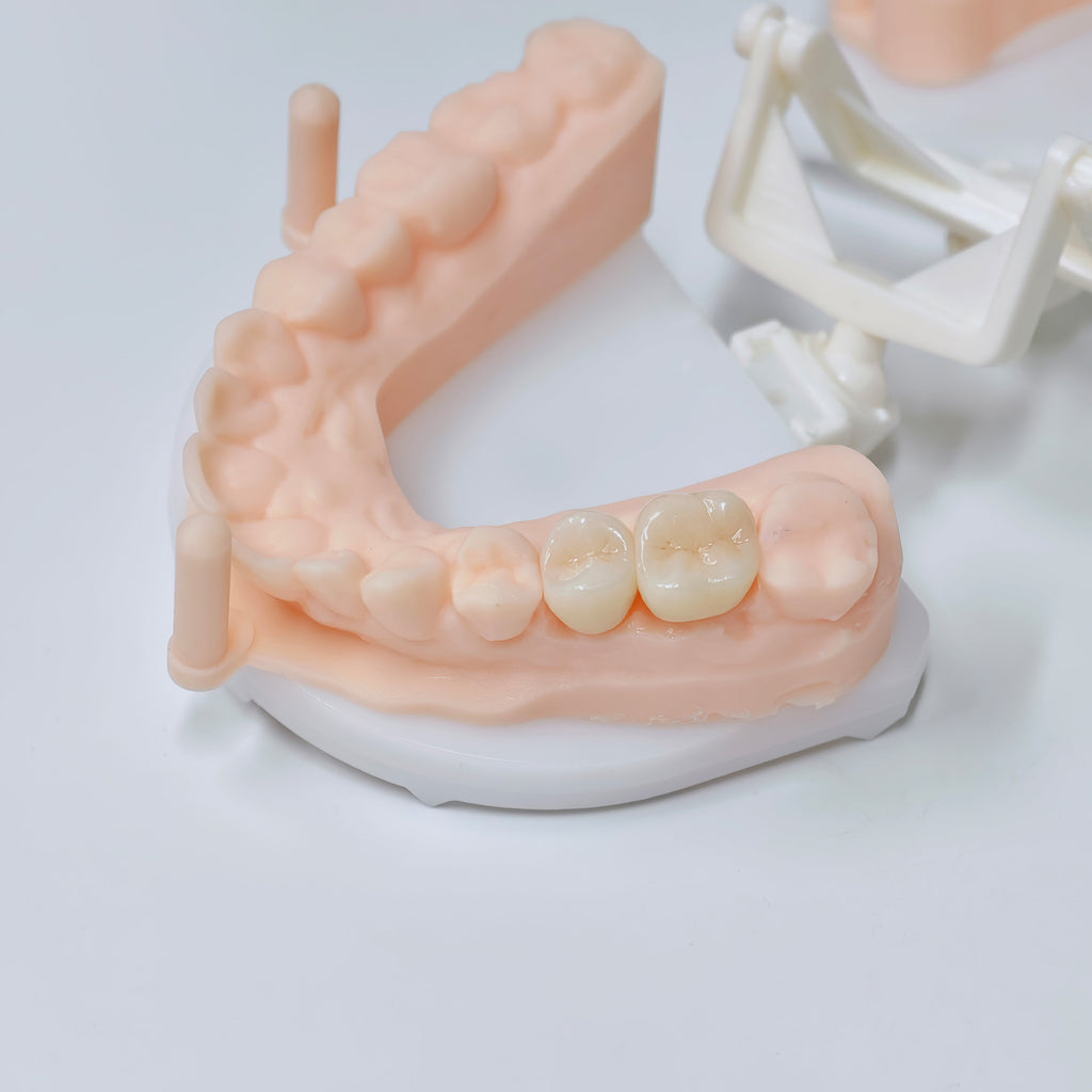 High - Strength Zirconia Crowns