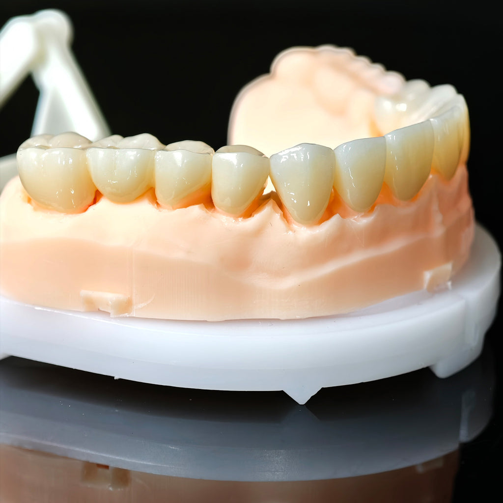High - Strength Zirconia Crowns And Bridge