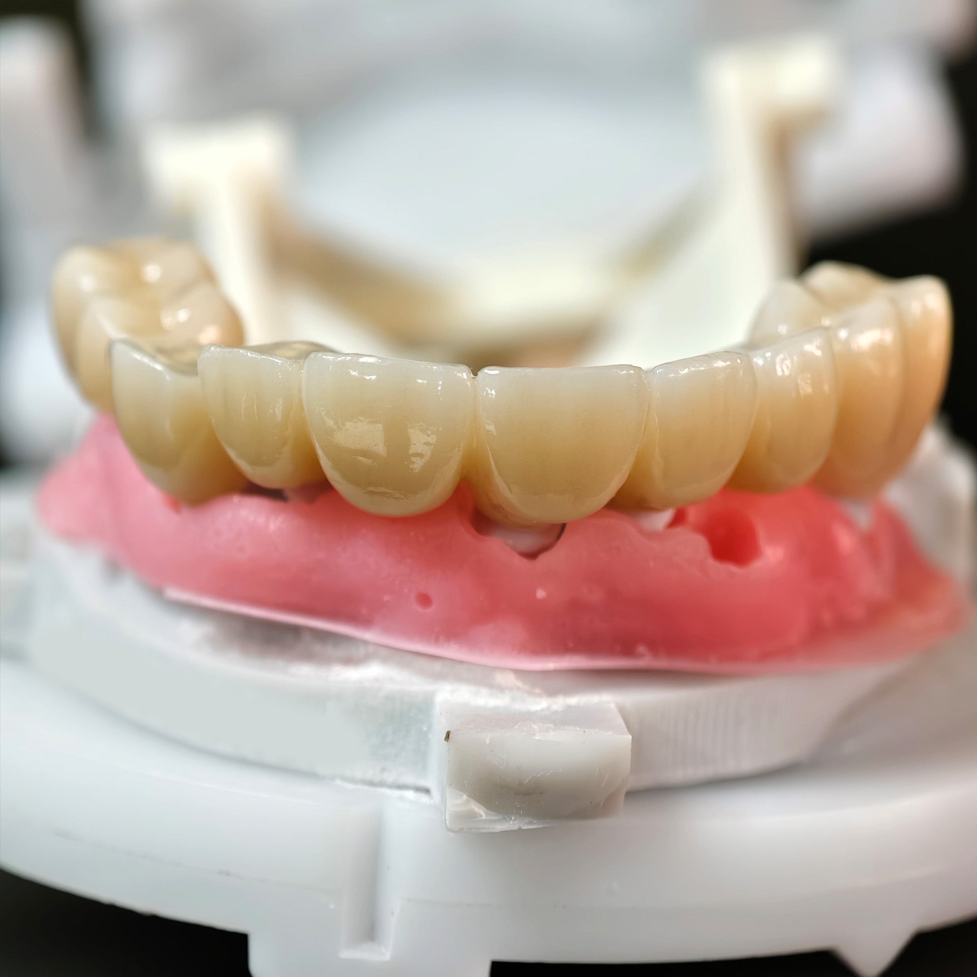 High - Strength Zirconia Crowns And Bridge