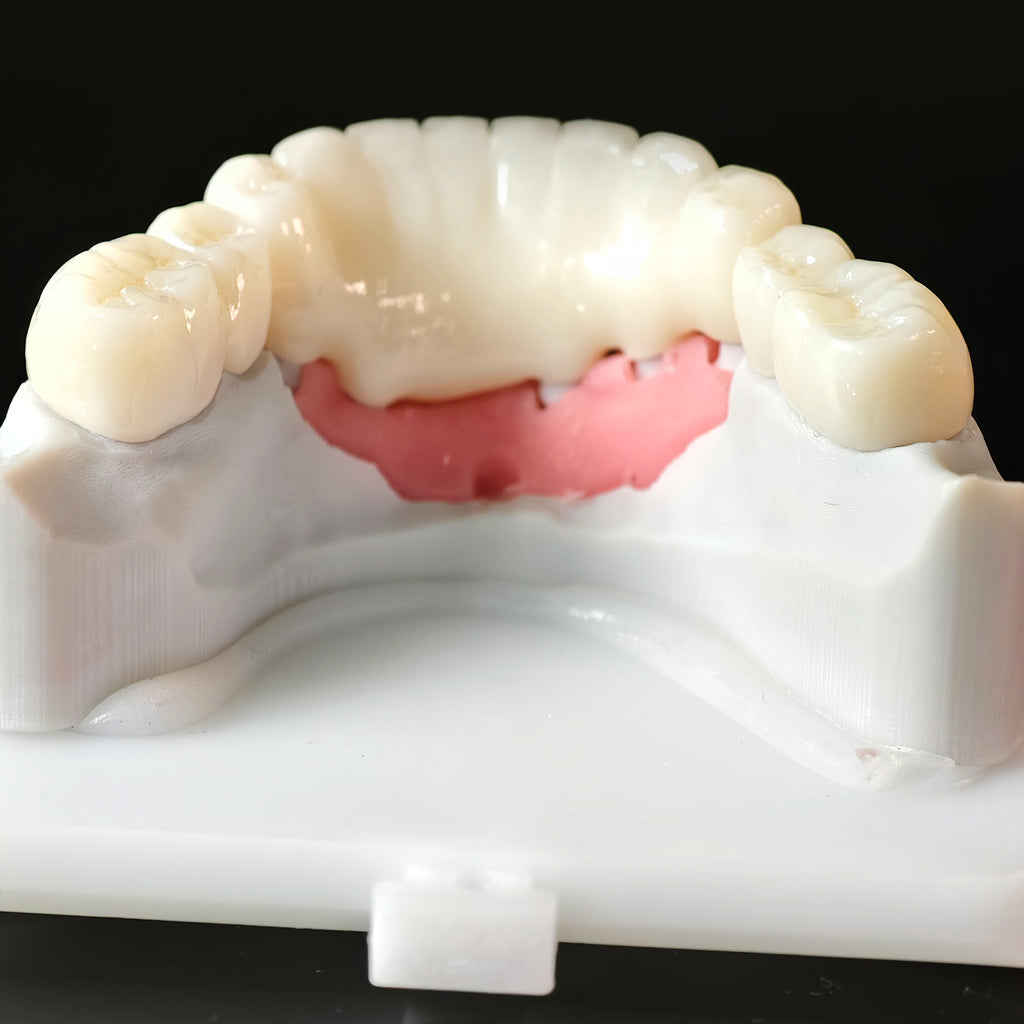 High - Strength Zirconia Crowns And Bridge