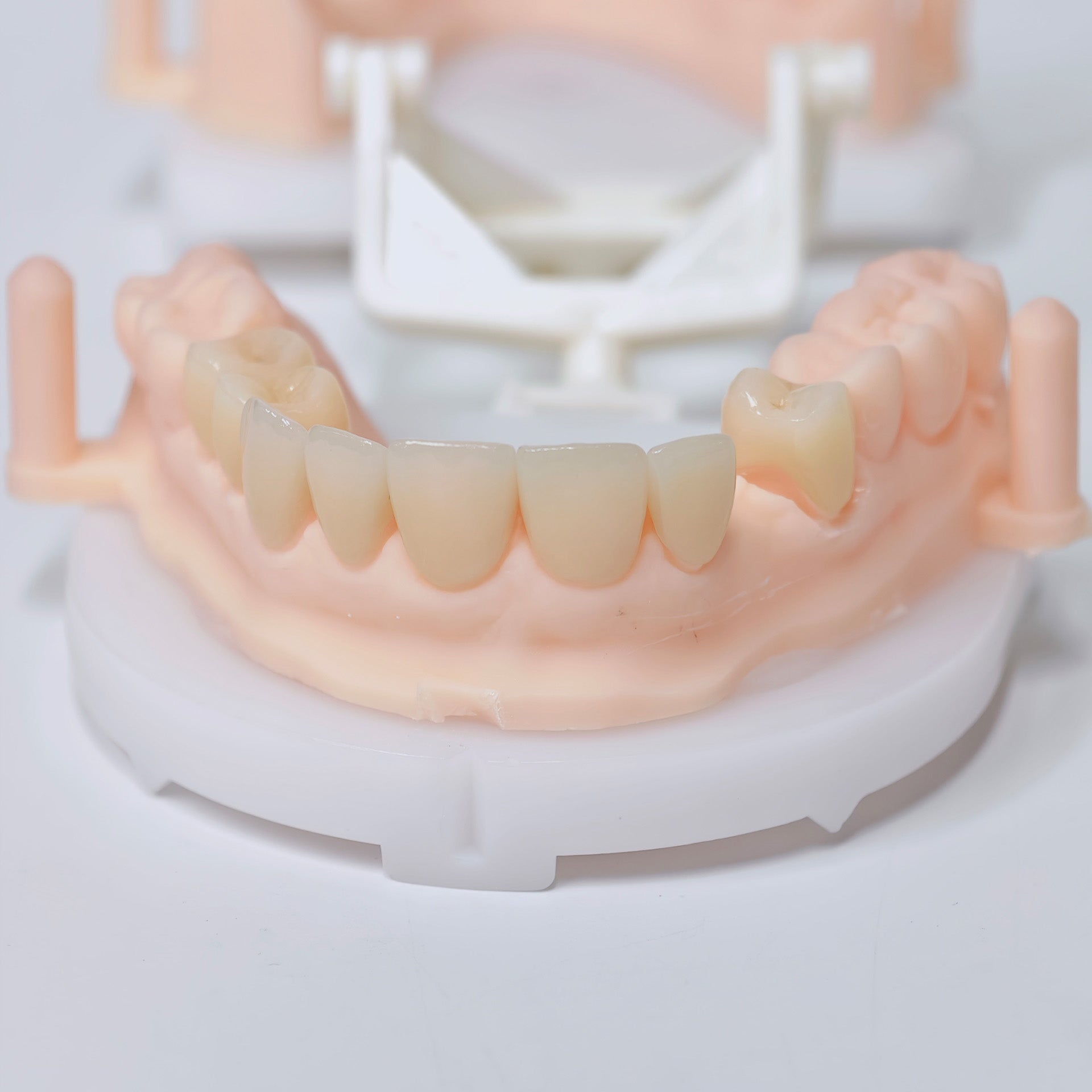 High - Strength Zirconia Crowns And Ceramic Veneers