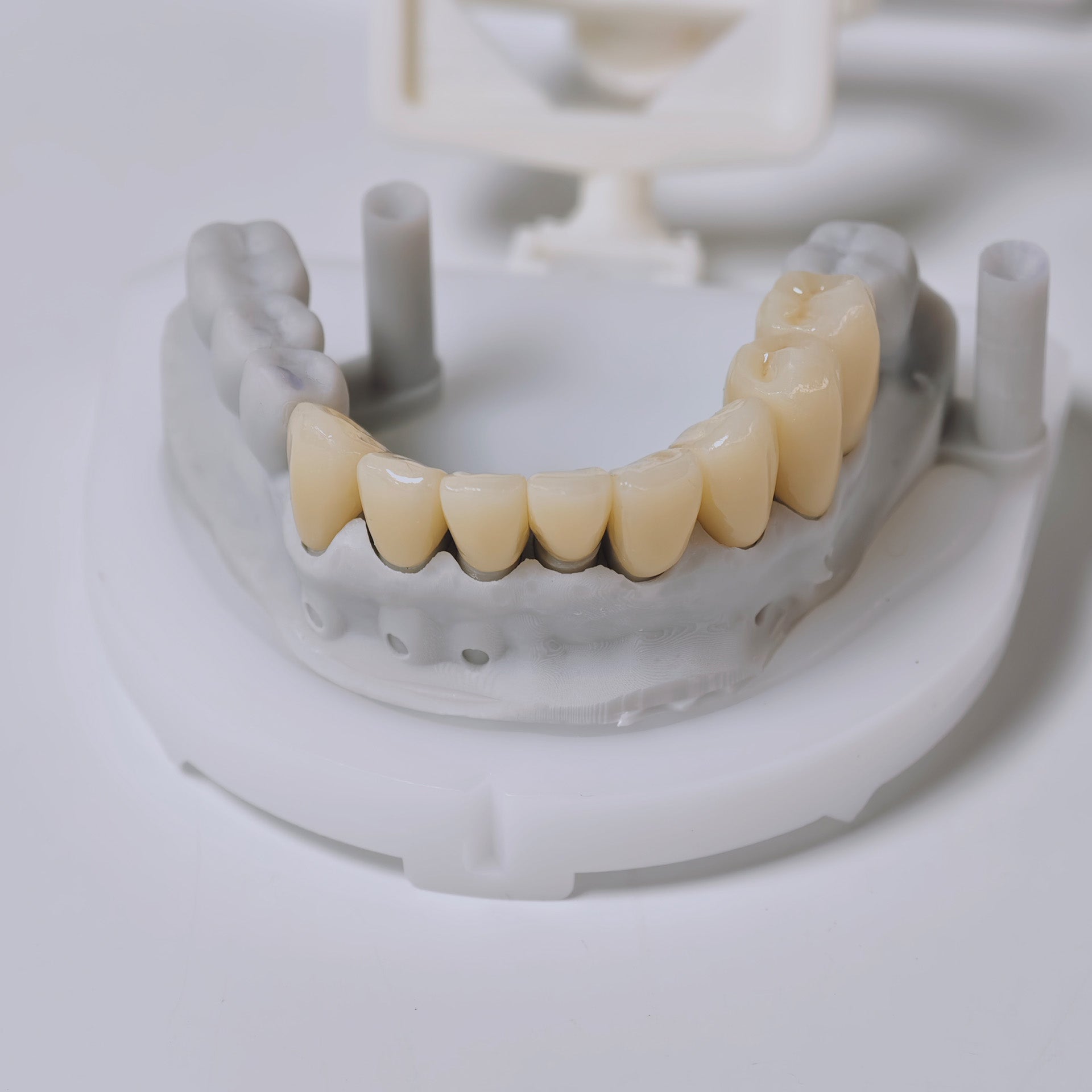 High - Strength Zirconia Crown with Post and core