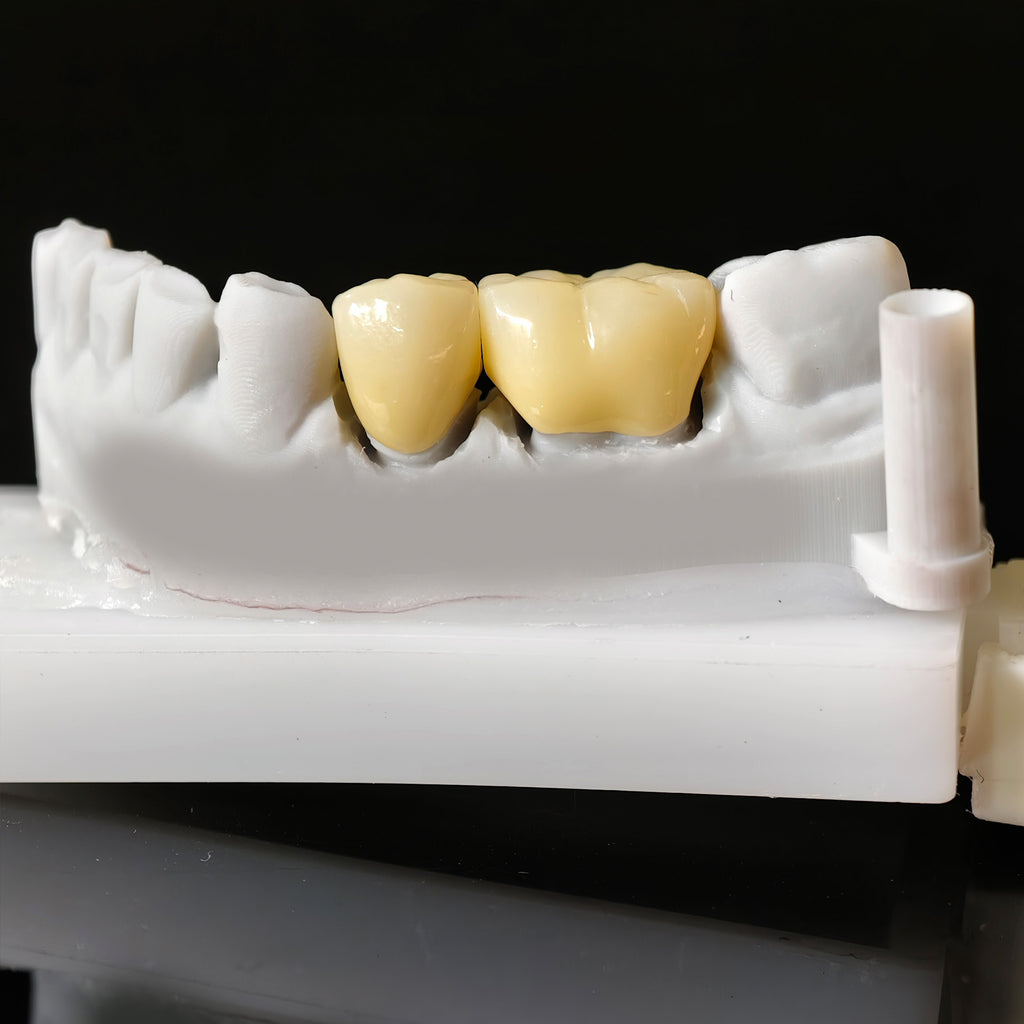High - Strength Zirconia Dental Crowns