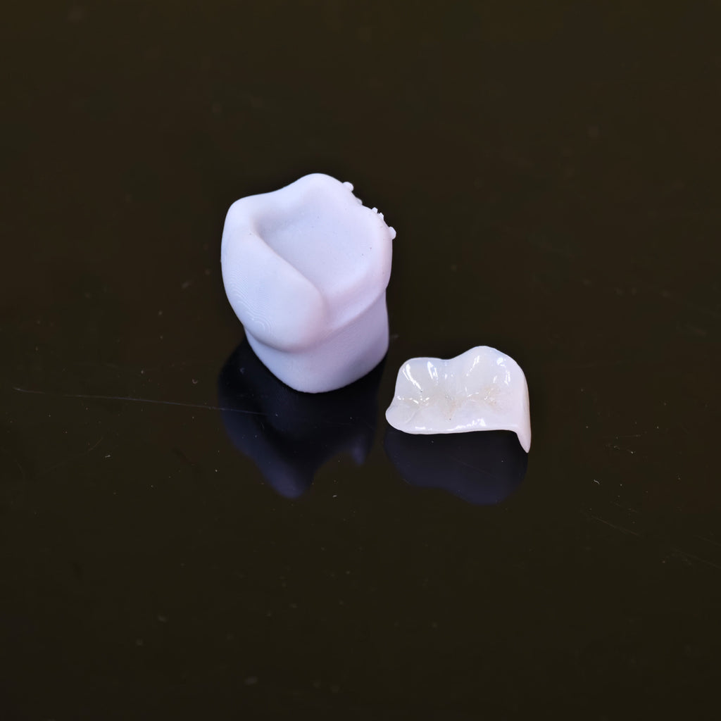 High - Strength Zirconia Inlay And Crown