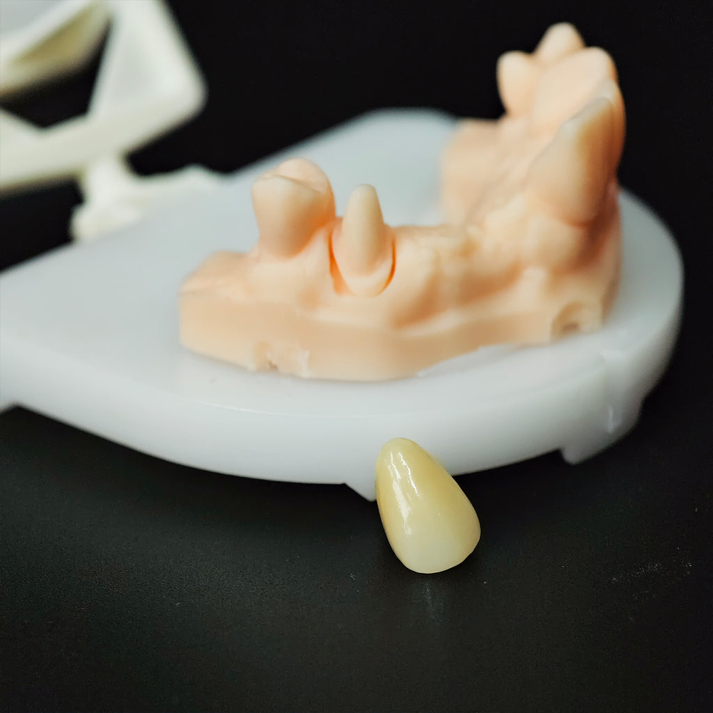 High - Strength Zirconia Crown
