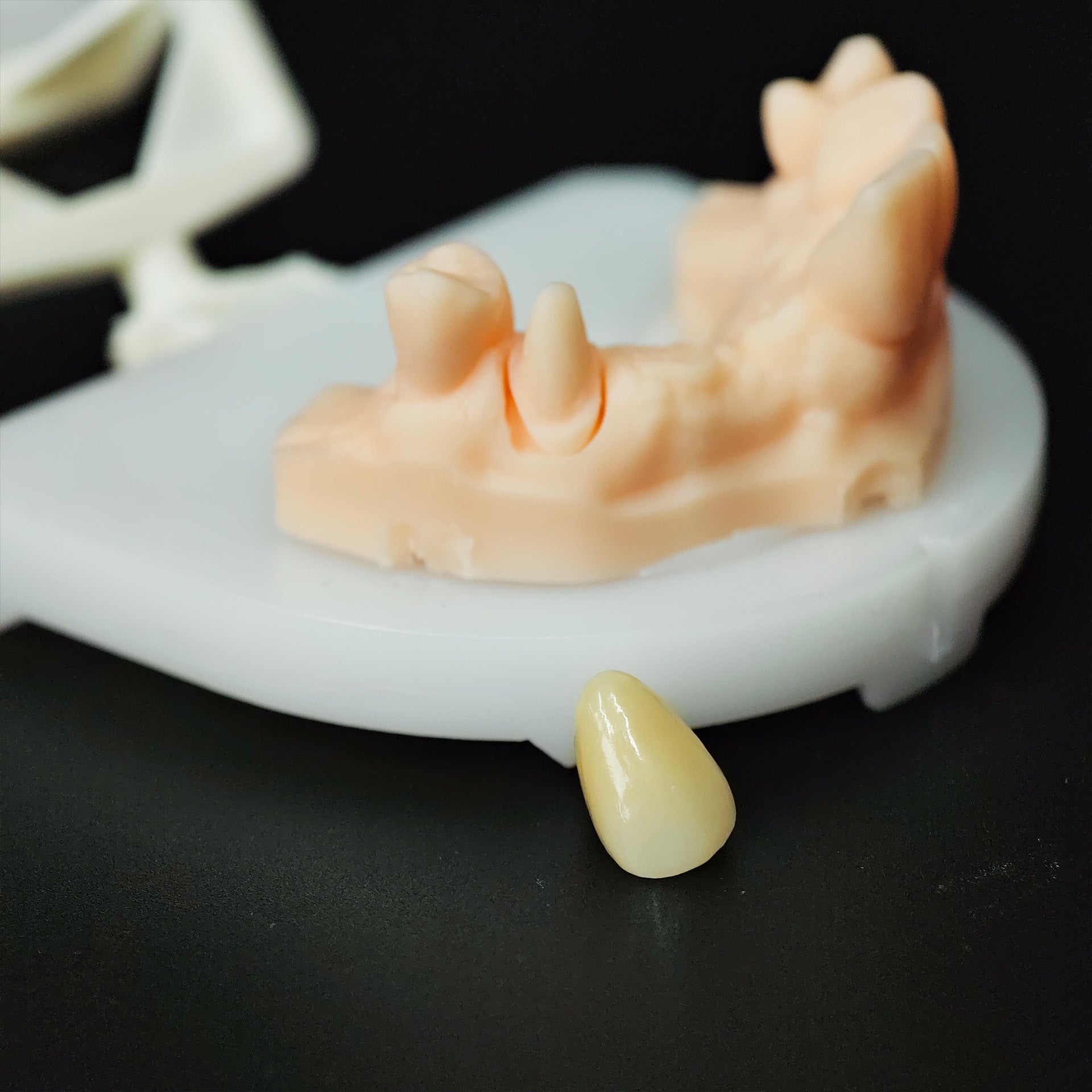 High - Strength Zirconia Crown