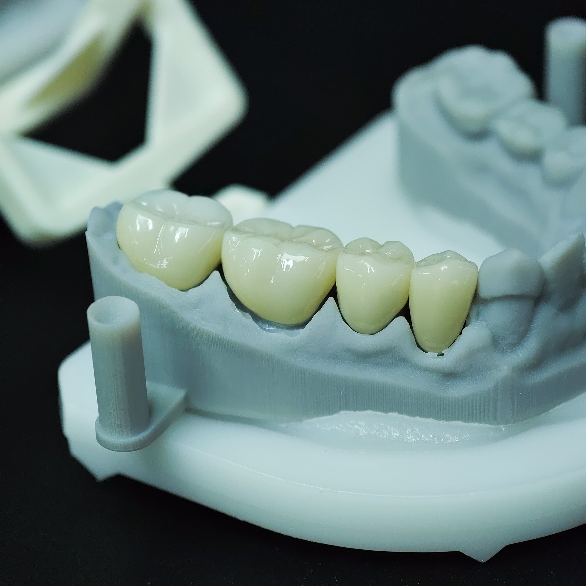 High - Strength Zirconia Crowns