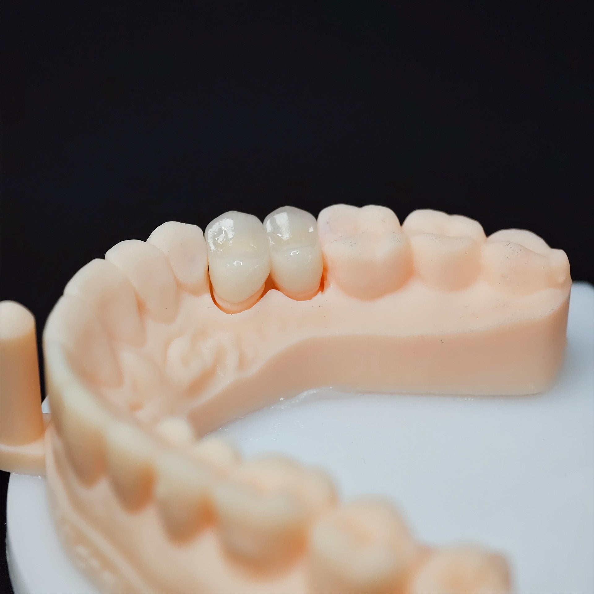 High - Strength Zirconia Crowns