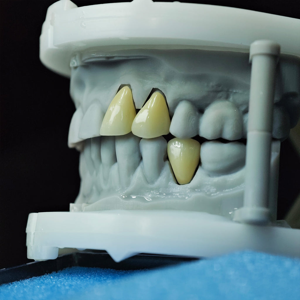 High - Strength Zirconia Crowns