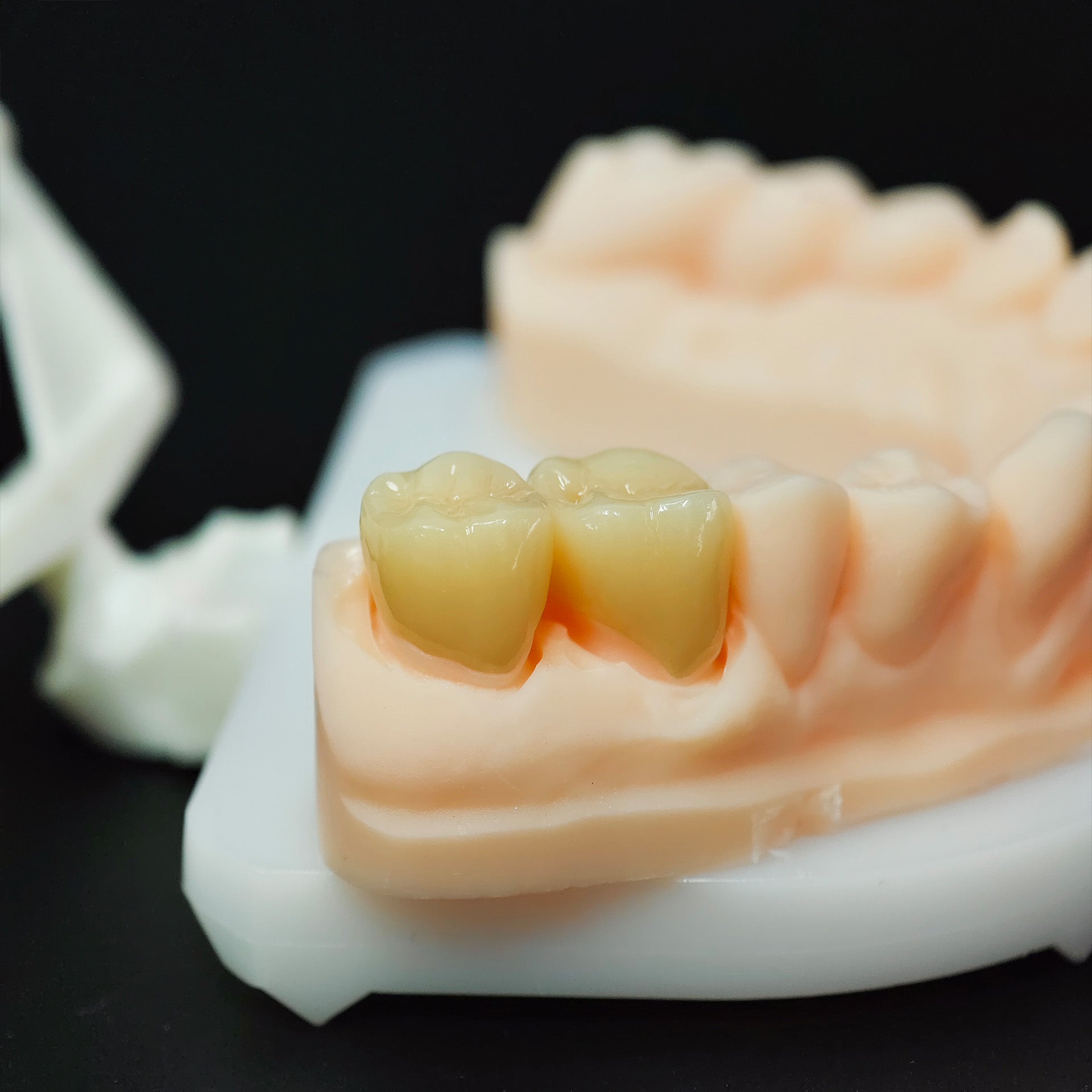 High - Strength Zirconia Crowns