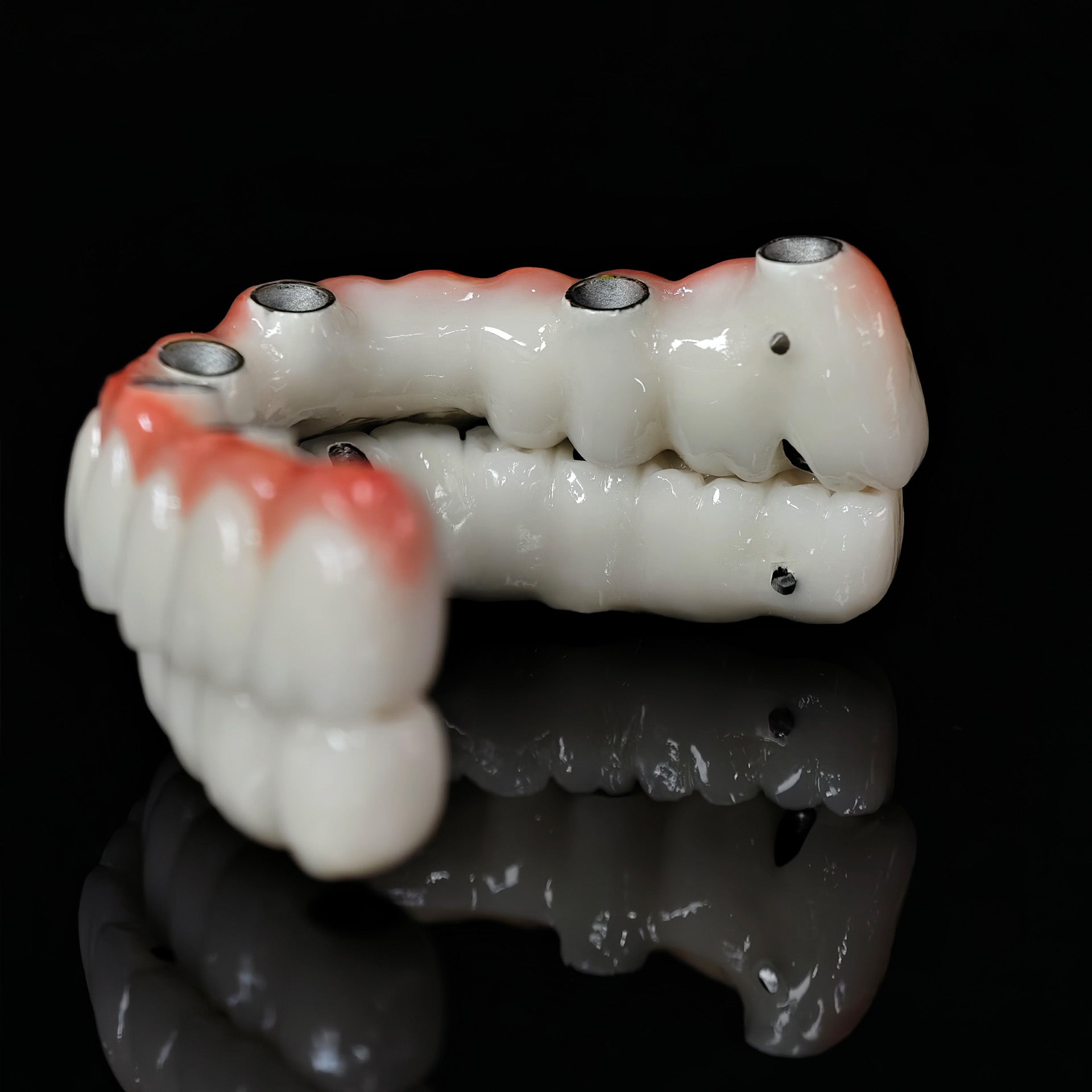 Implant-supported Co - Cr PFM Dental Bridge