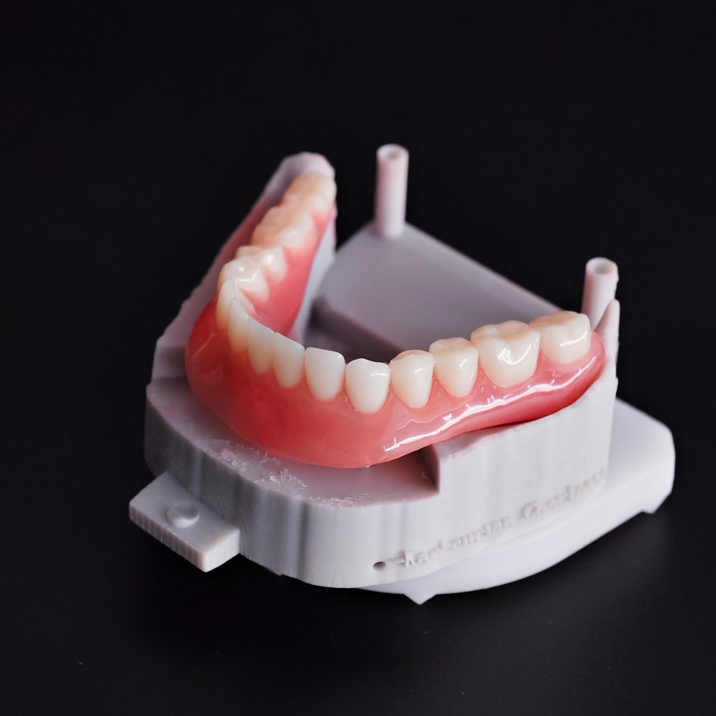 Locator Overdenture Implant Acrylic Denture Restoration
