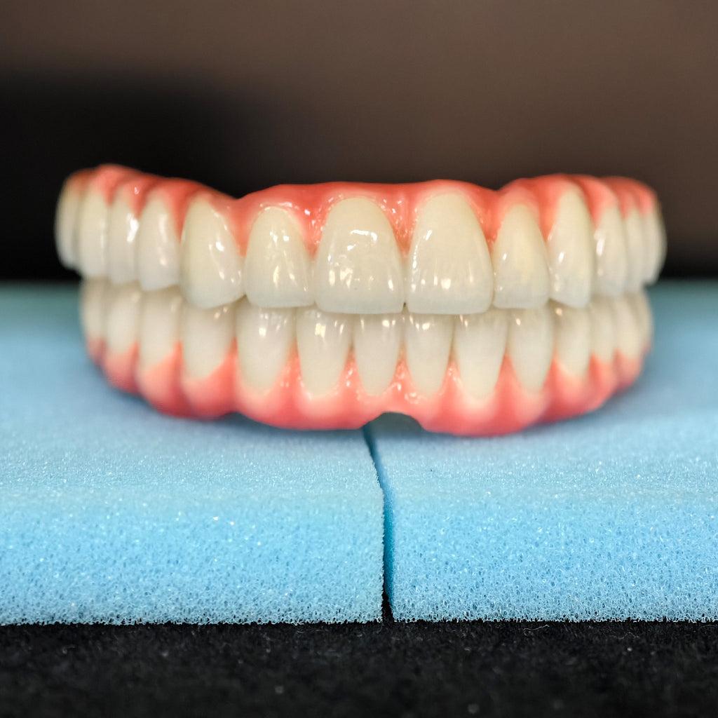 Malo Bridge Implant Restorations