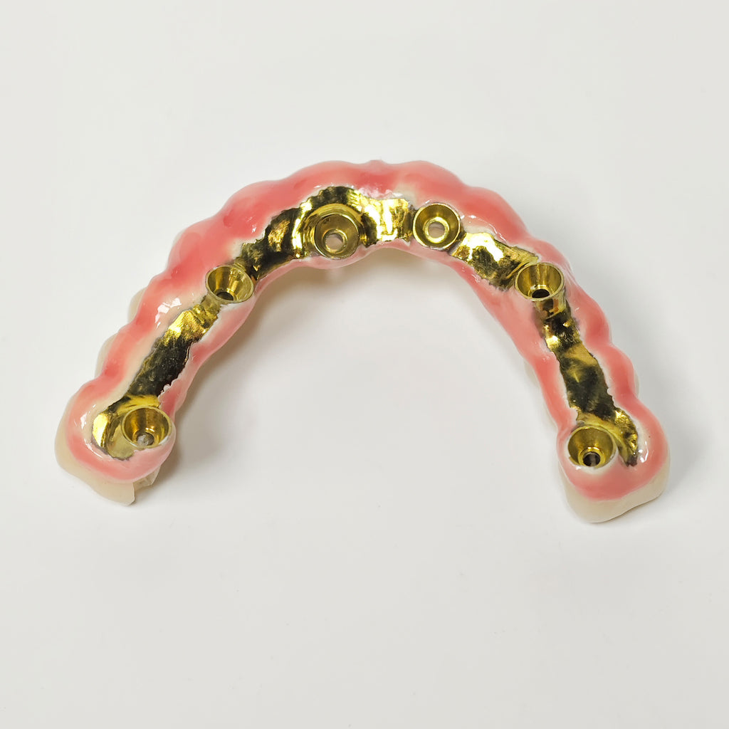 Malo Bridge With Gold-Plated Titanium Framework And A Gold Crown