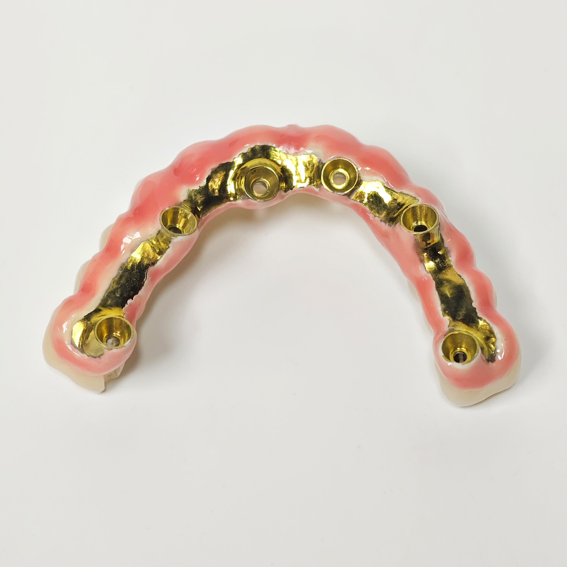 Malo Bridge With Gold-Plated Titanium Framework And A Gold Crown