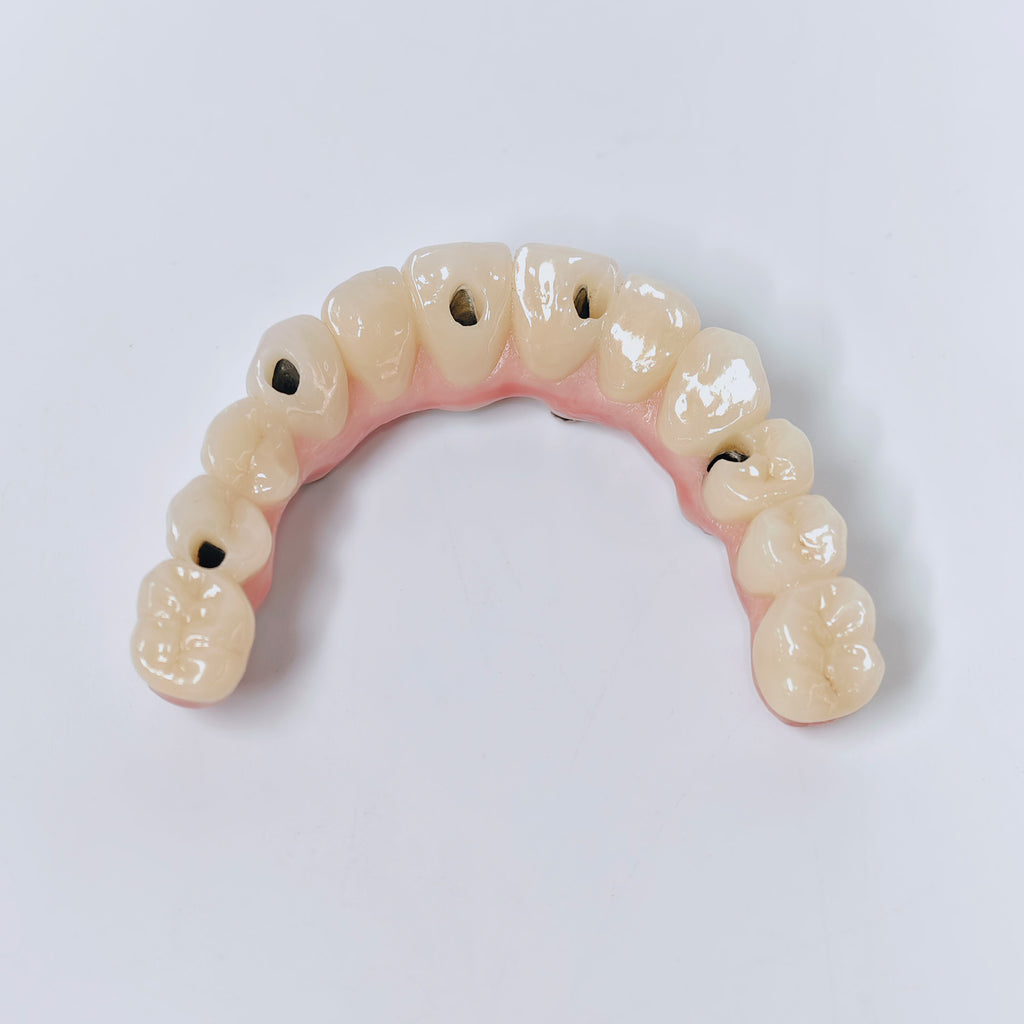 Malo Bridge With Screw-Retained