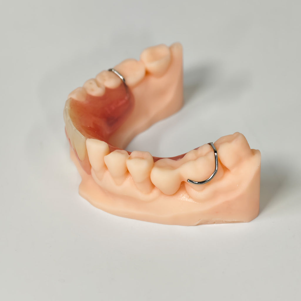 Metal Clasp Partial Denture