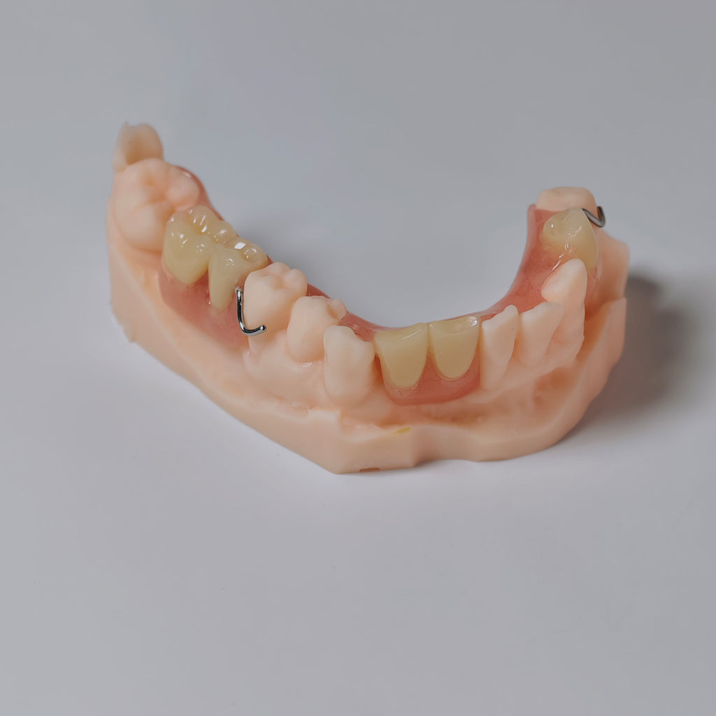 Metal Clasp Partial Denture