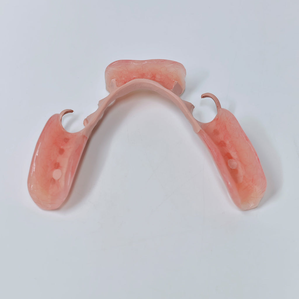 PEEK Framework Denture Metal Framework With Acrylic Denture