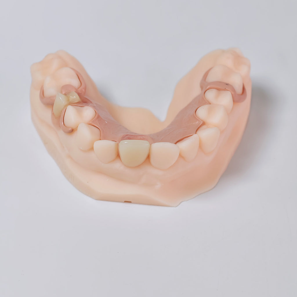 PEEK Framework Denture Metal Framework With Acrylic Denture