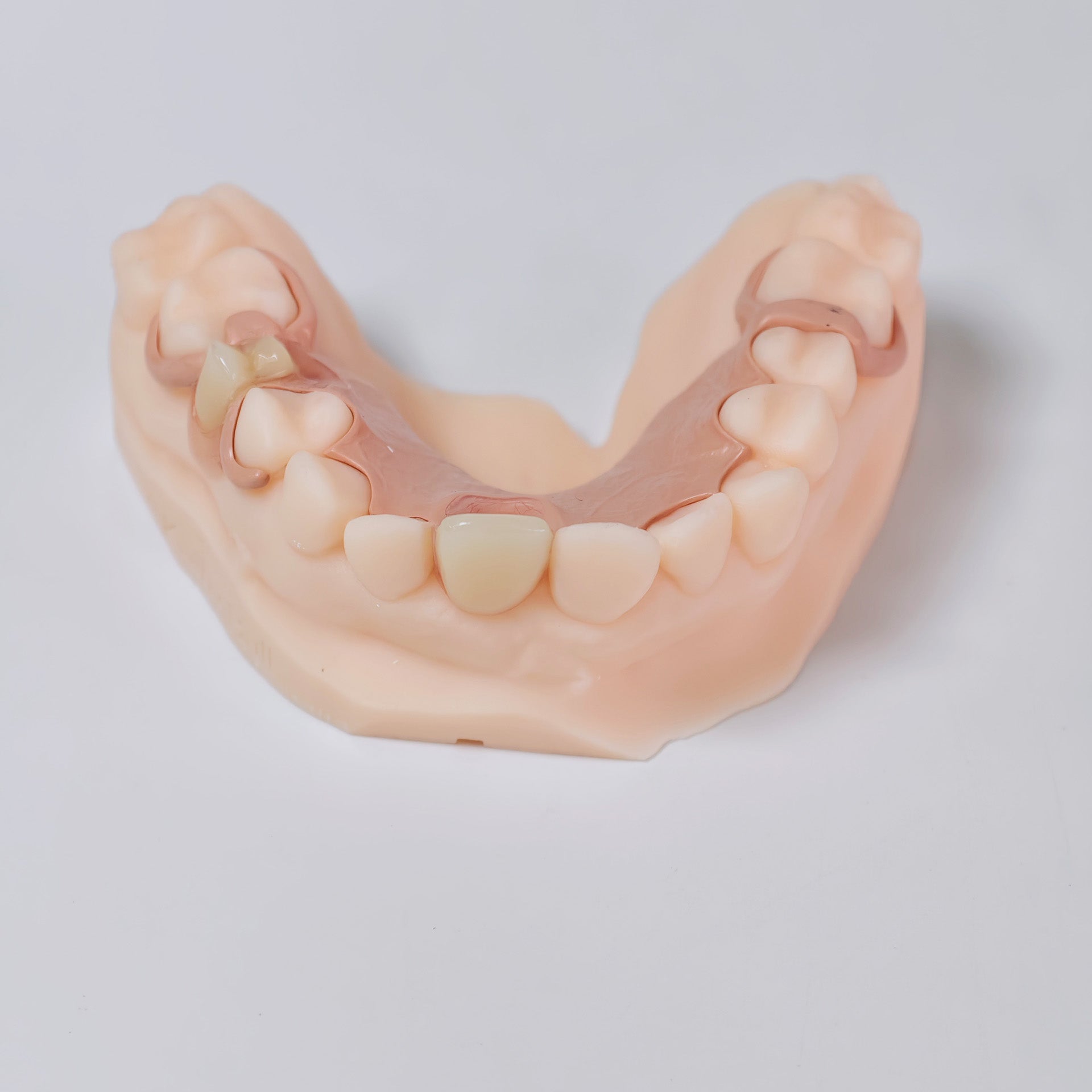 PEEK Framework Denture Metal Framework With Acrylic Denture