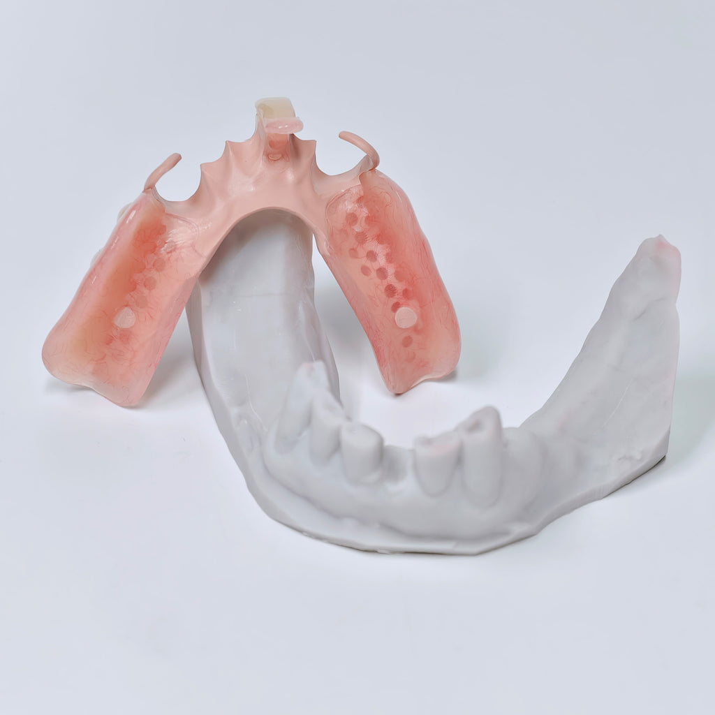 PEEK Framework Denture Metal Framework With Acrylic Denture