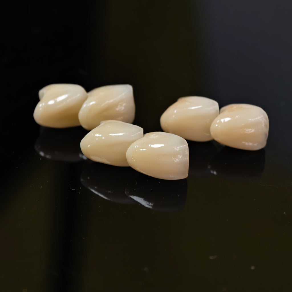 PFZ Crowns Aesthetic Shape Natural Shade Dental Crown