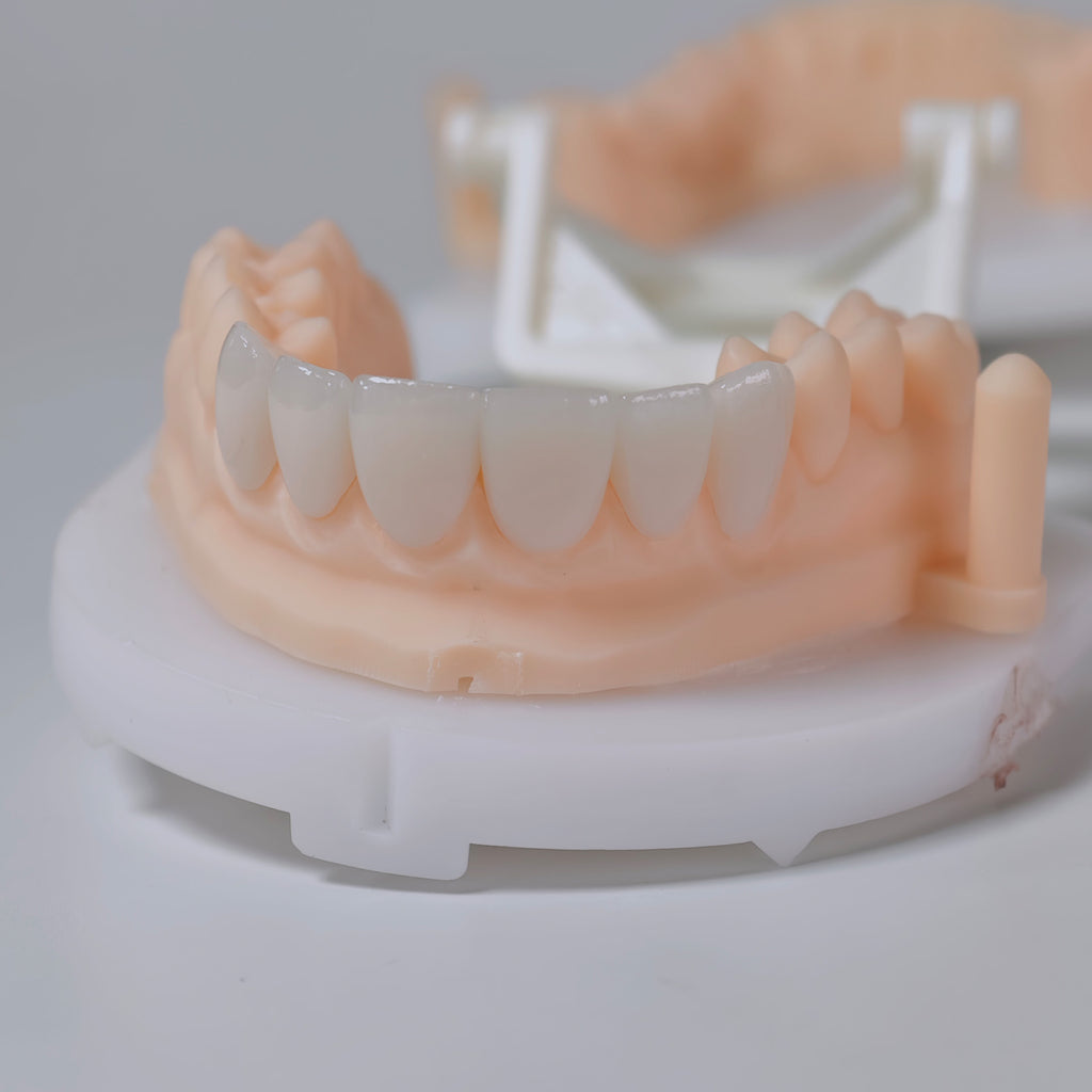 PFZ Porcelain Fused Zirconia Aidite Zirconia