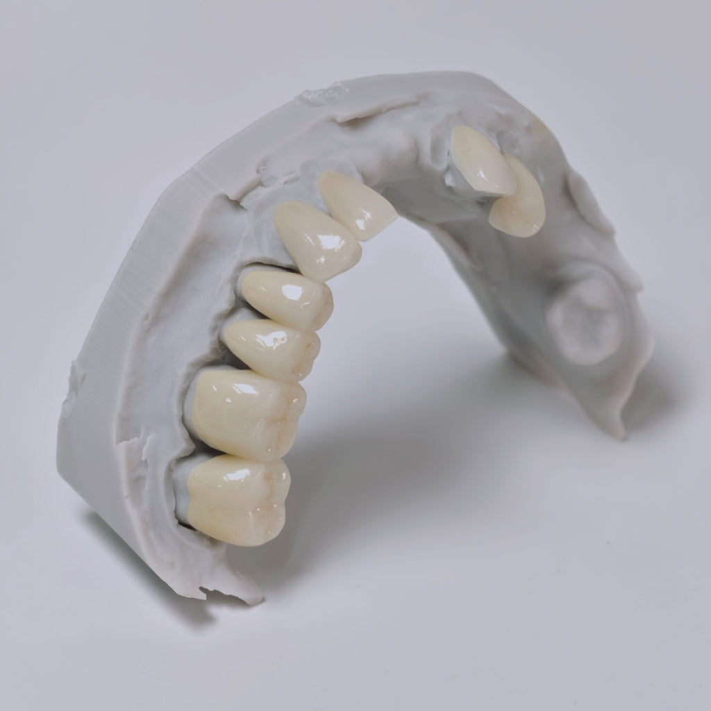 PFZ Porcelain Fused Zirconia Aidite Zirconia