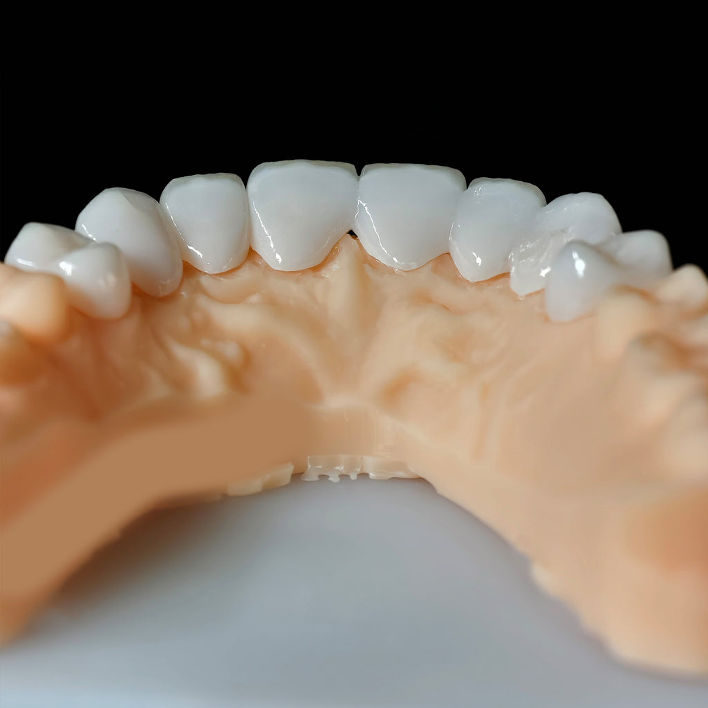 PFZ Porcelain Fused Zirconia Aidite Zirconia