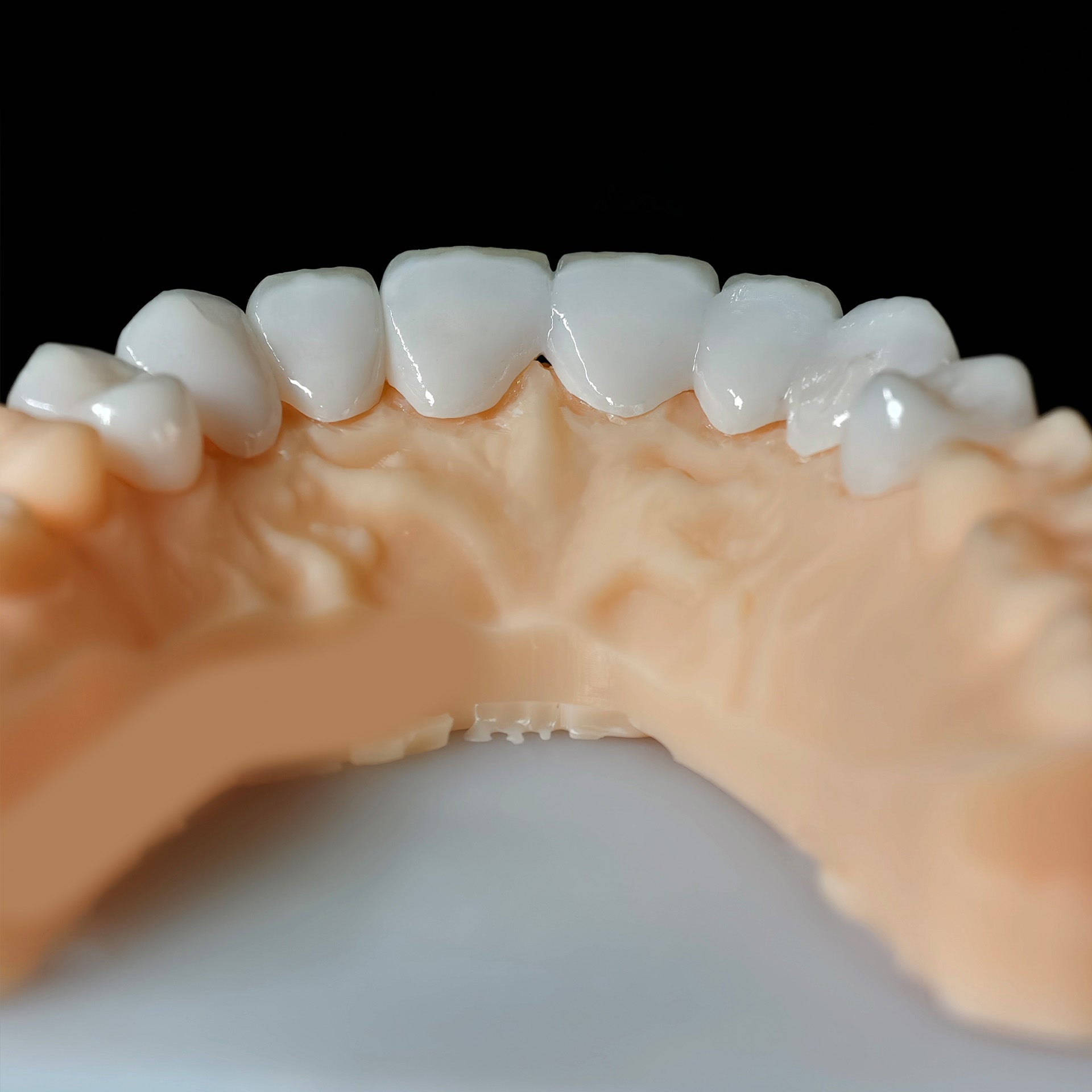 PFZ Porcelain Fused Zirconia Aidite Zirconia