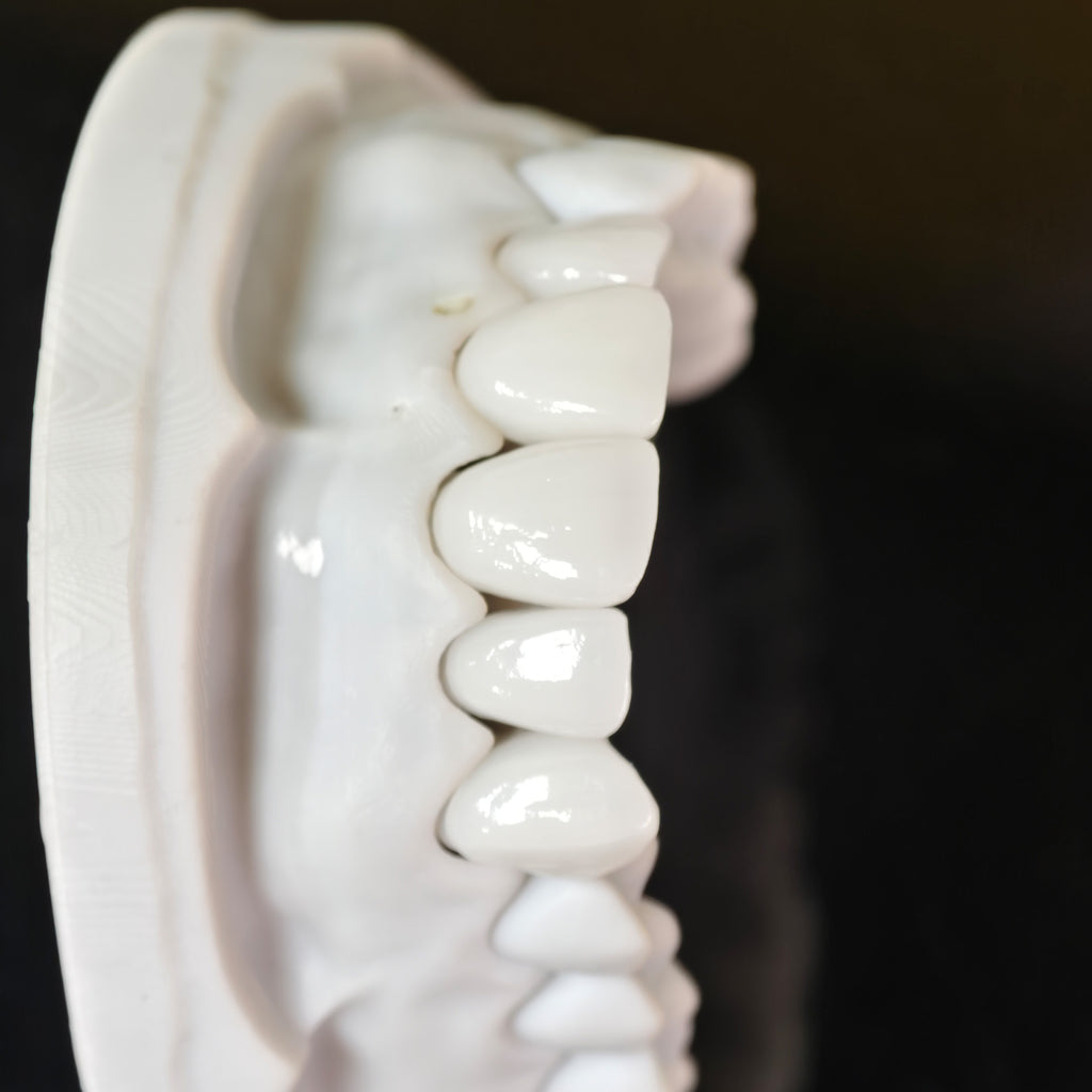 PFZ Porcelain Fused Zirconia Aidite Zirconia