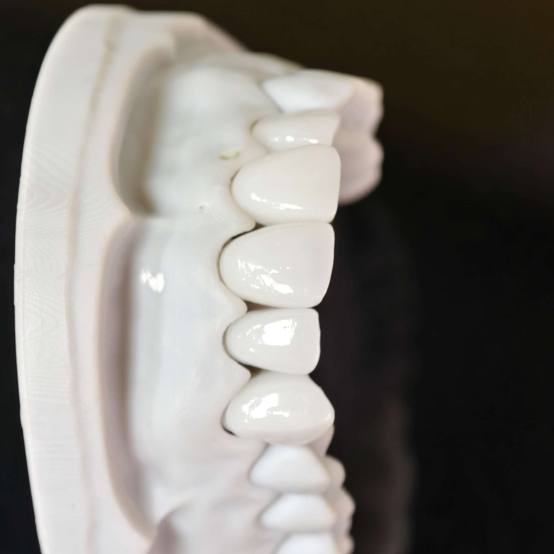 PFZ Porcelain Fused Zirconia Aidite Zirconia