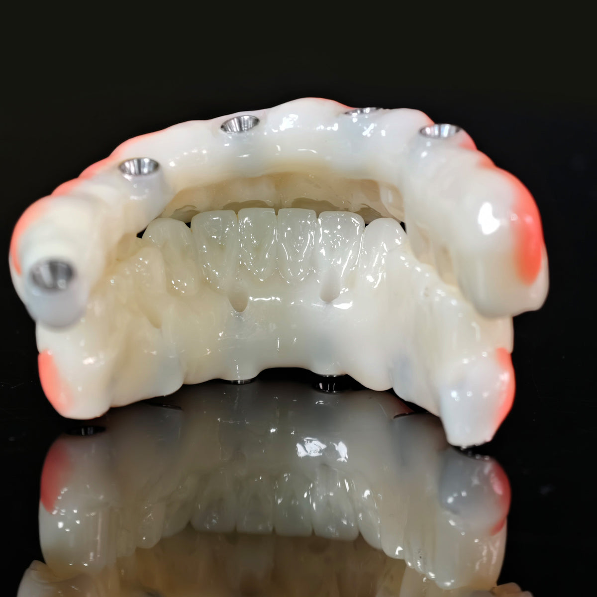 PMMA Bridge With Ti-Base Screw Retained Trying For Full Arch Restoration