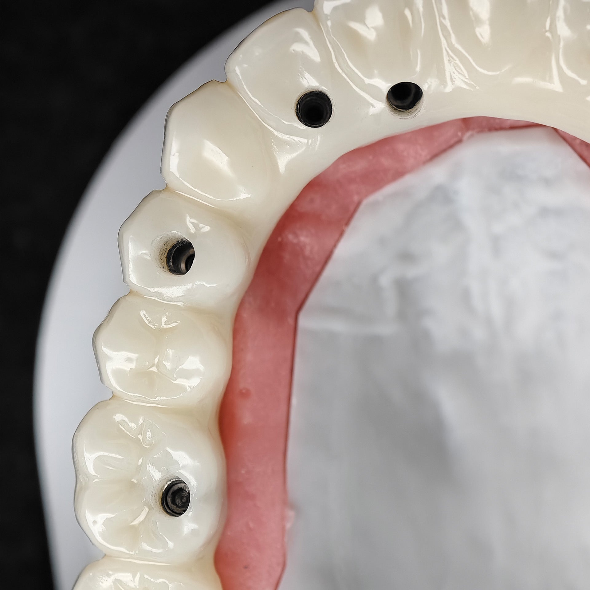 PMMA Bridge With Ti-Base Screw Retained Trying For Full Arch Restoration