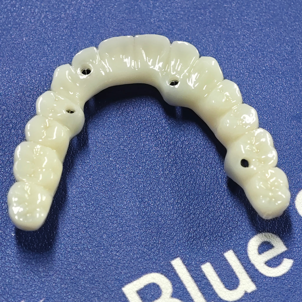 PMMA Bridge With Ti-Base Screw Retained Trying For Full Arch Restoration