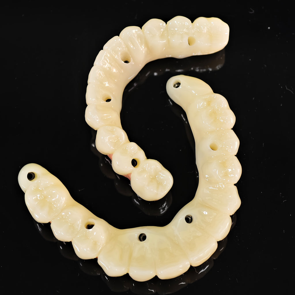 PMMA Bridge With Ti-Base Screw Retained Trying For Full Arch Restoration