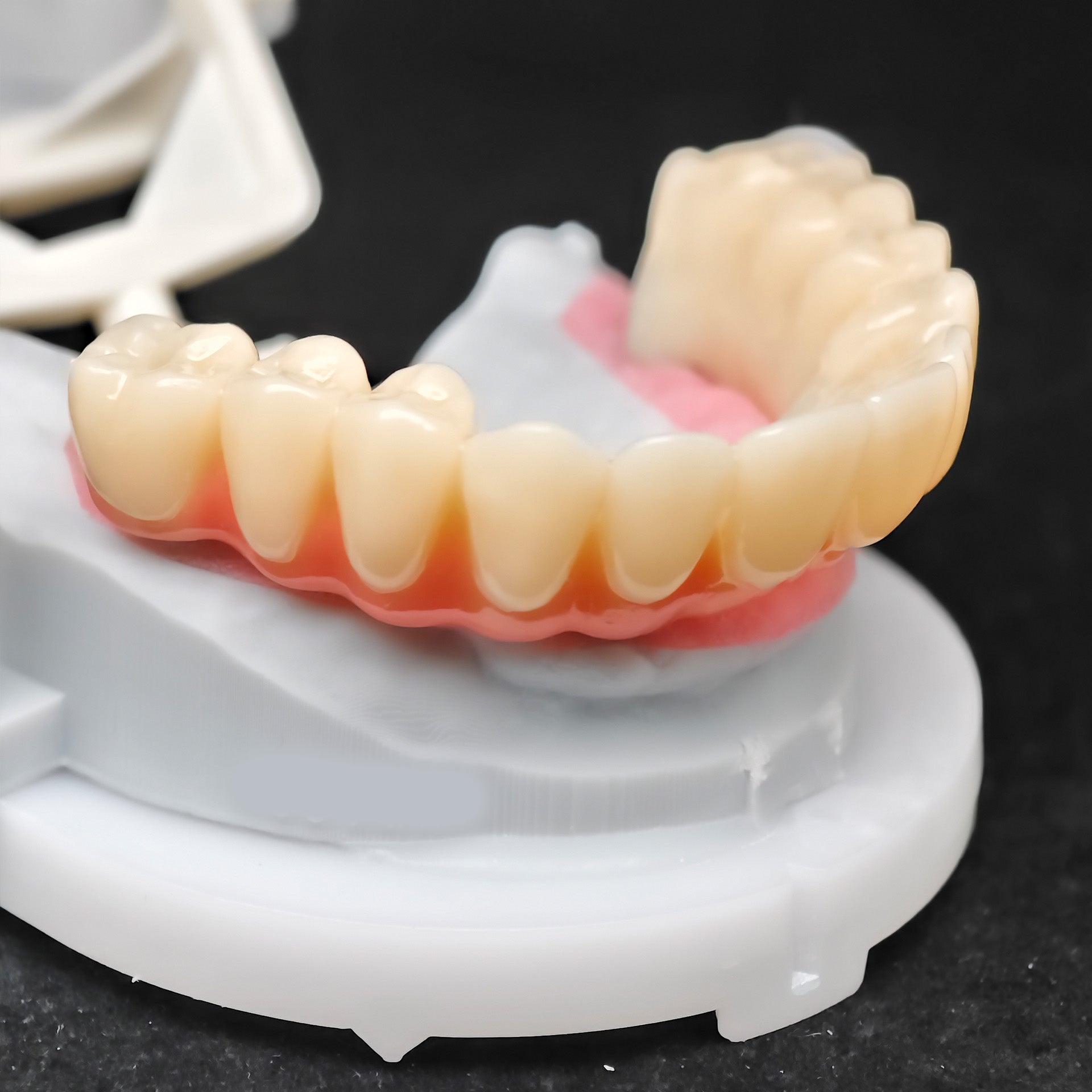 PMMA Bridge With Ti-Base Screw Retained Trying For Full Arch Restoration
