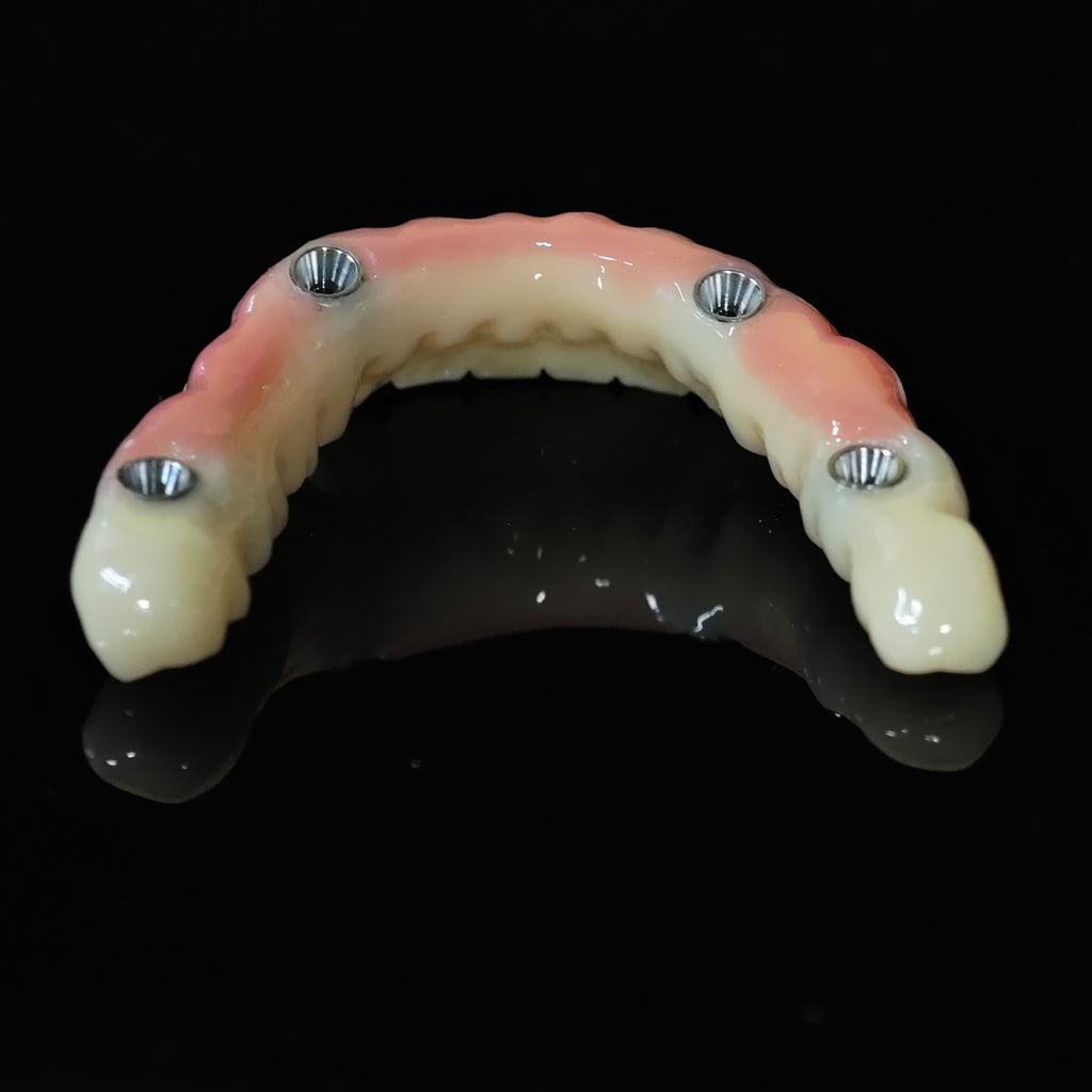 PMMA Bridge With Ti-Base Screw Retained Trying For Full Arch Restoration